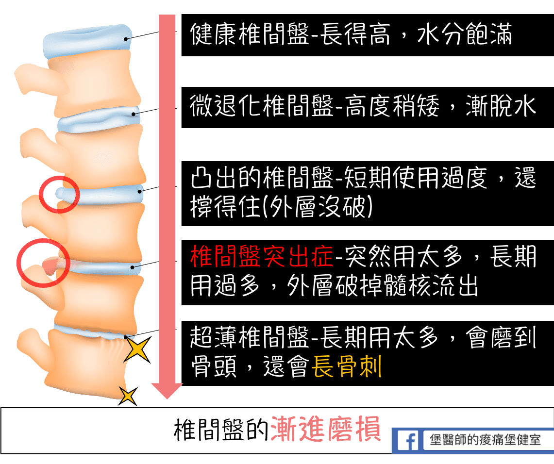 椎間盤退化過程
