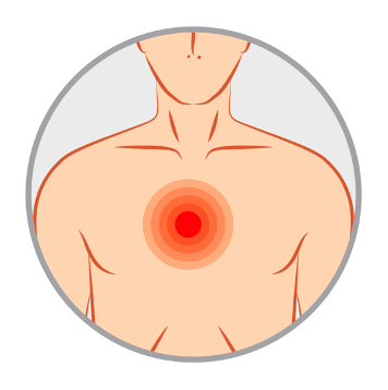 胸部激痛點 chest pain