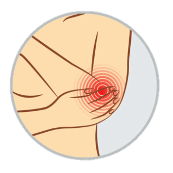 手肘激痛點 elbow pain