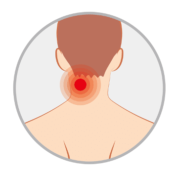頸部激痛點 neck pain
