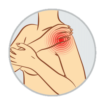 肩膀激痛點 shoulder pain