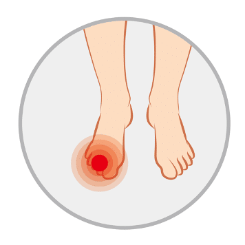 足部激痛點 digits pain