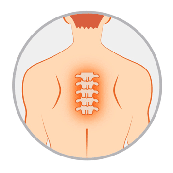 脊椎激痛點 Spine pain